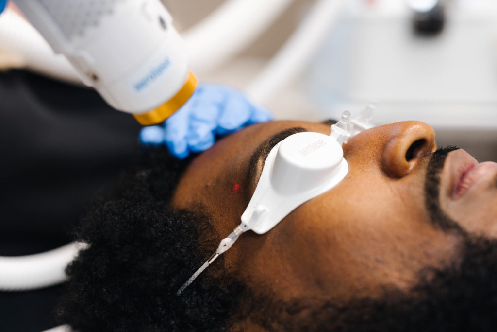 Man receiving a laser facial treatment in St. Louis